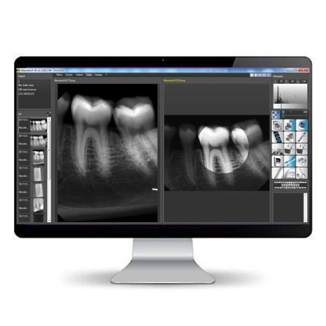 Intraoral Dental X Ray Sensor Ateco Brand Made in UK